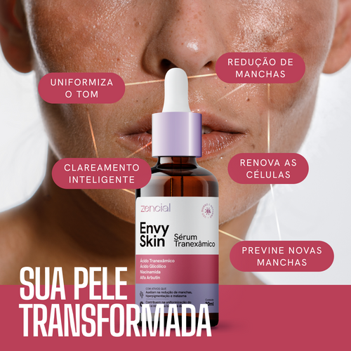 Envy Skin Serum Aclarante Antimanchas Ácido Tranexámico