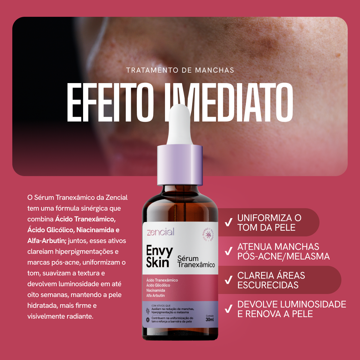 Envy Skin Serum Aclarante Antimanchas Ácido Tranexámico