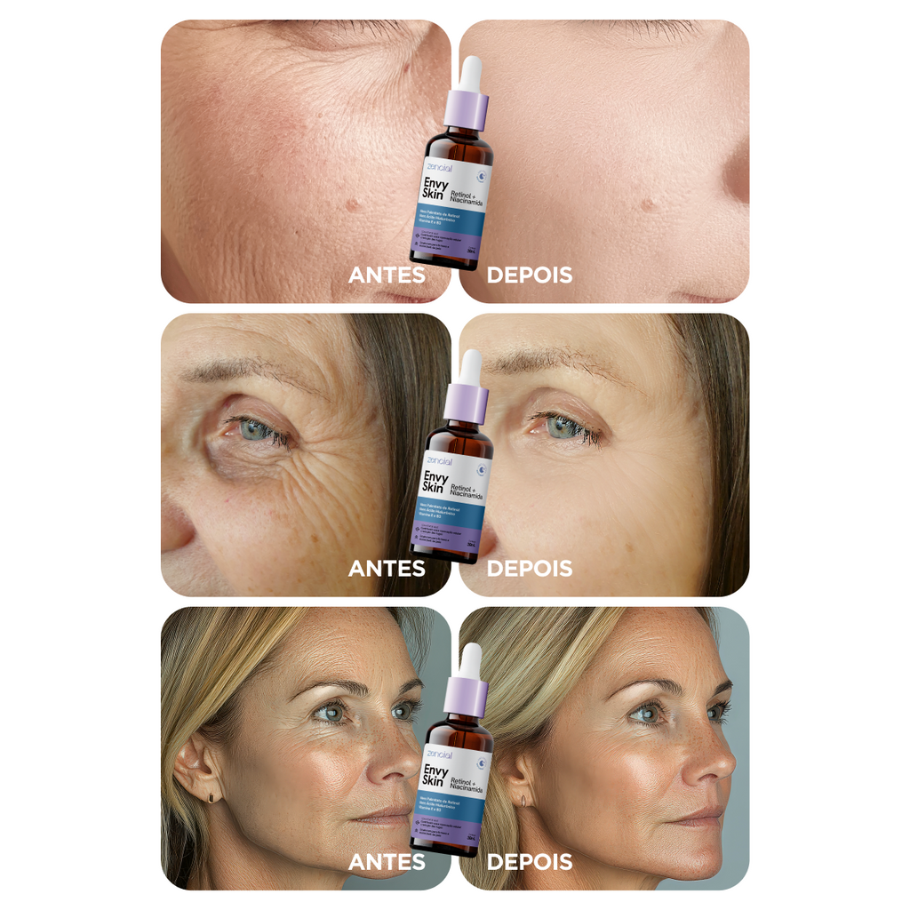 Envy Skin Nano Retinol + Niacinamida Serum Antiedad 30ml