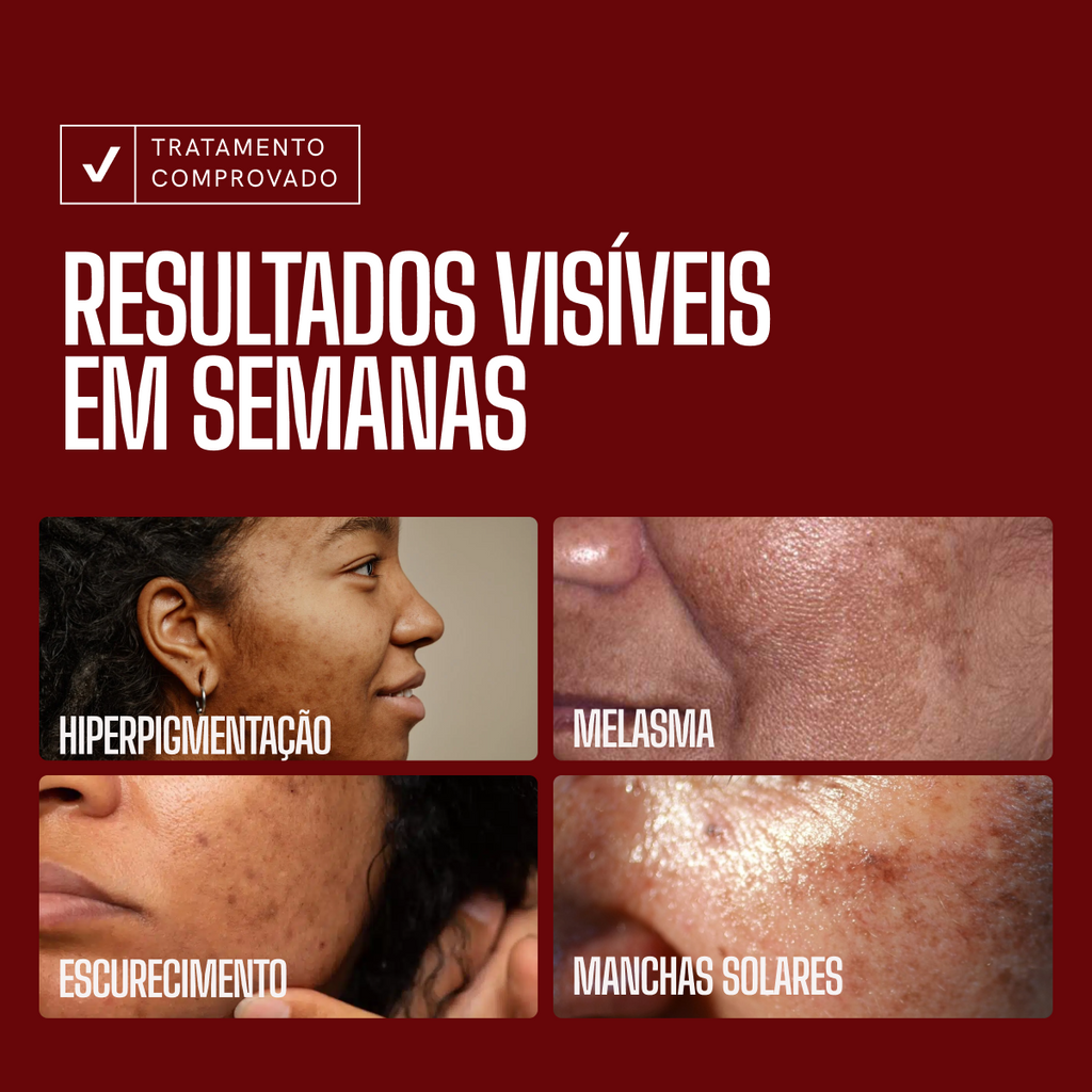 Envy Skin Serum Aclarante Antimanchas Ácido Tranexámico