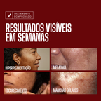 Envy Skin Serum Aclarante Antimanchas Ácido Tranexámico