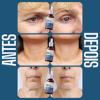 Envy Skin Nano Retinol + Niacinamida Serum Antiedad 30ml