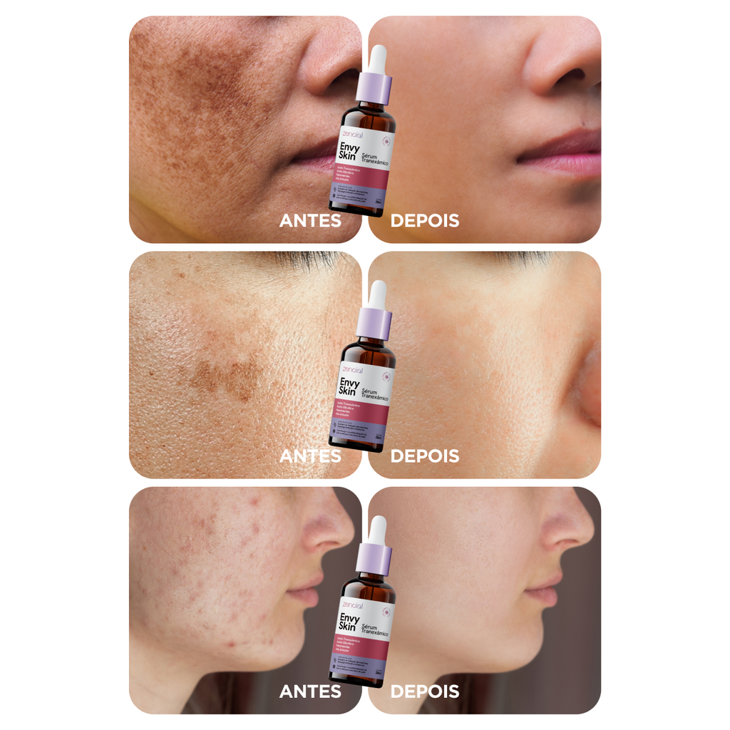 Envy Skin Serum Aclarante Antimanchas Ácido Tranexámico