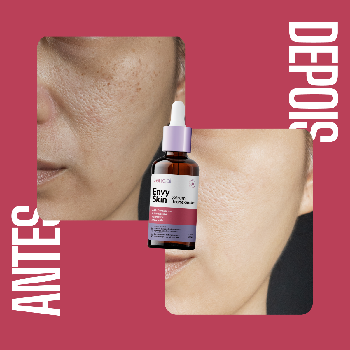 Envy Skin Serum Aclarante Antimanchas Ácido Tranexámico