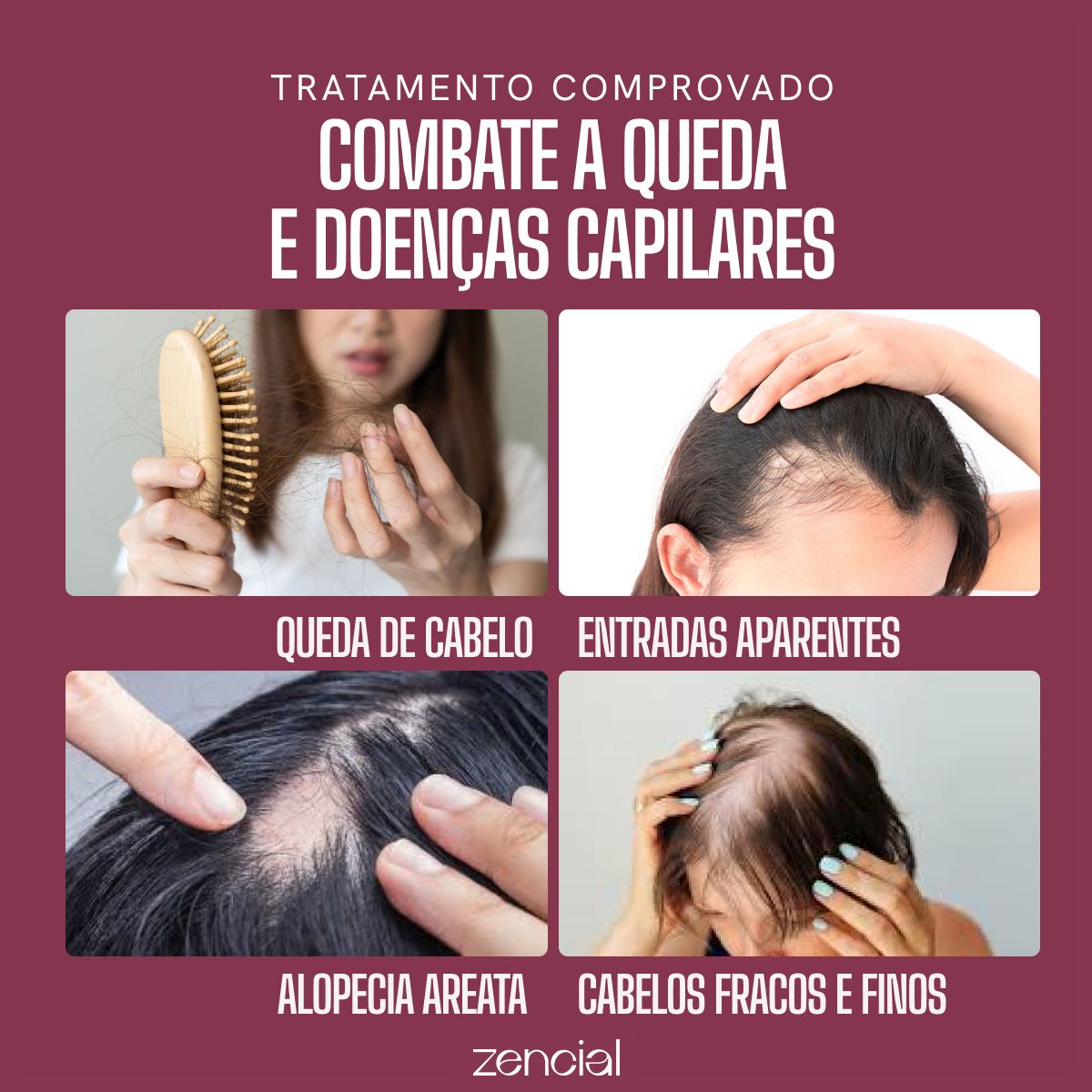 Aceite Capilar Envy Hair Sérum de Crecimiento