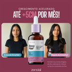 Aceite Capilar Envy Hair Sérum de Crecimiento